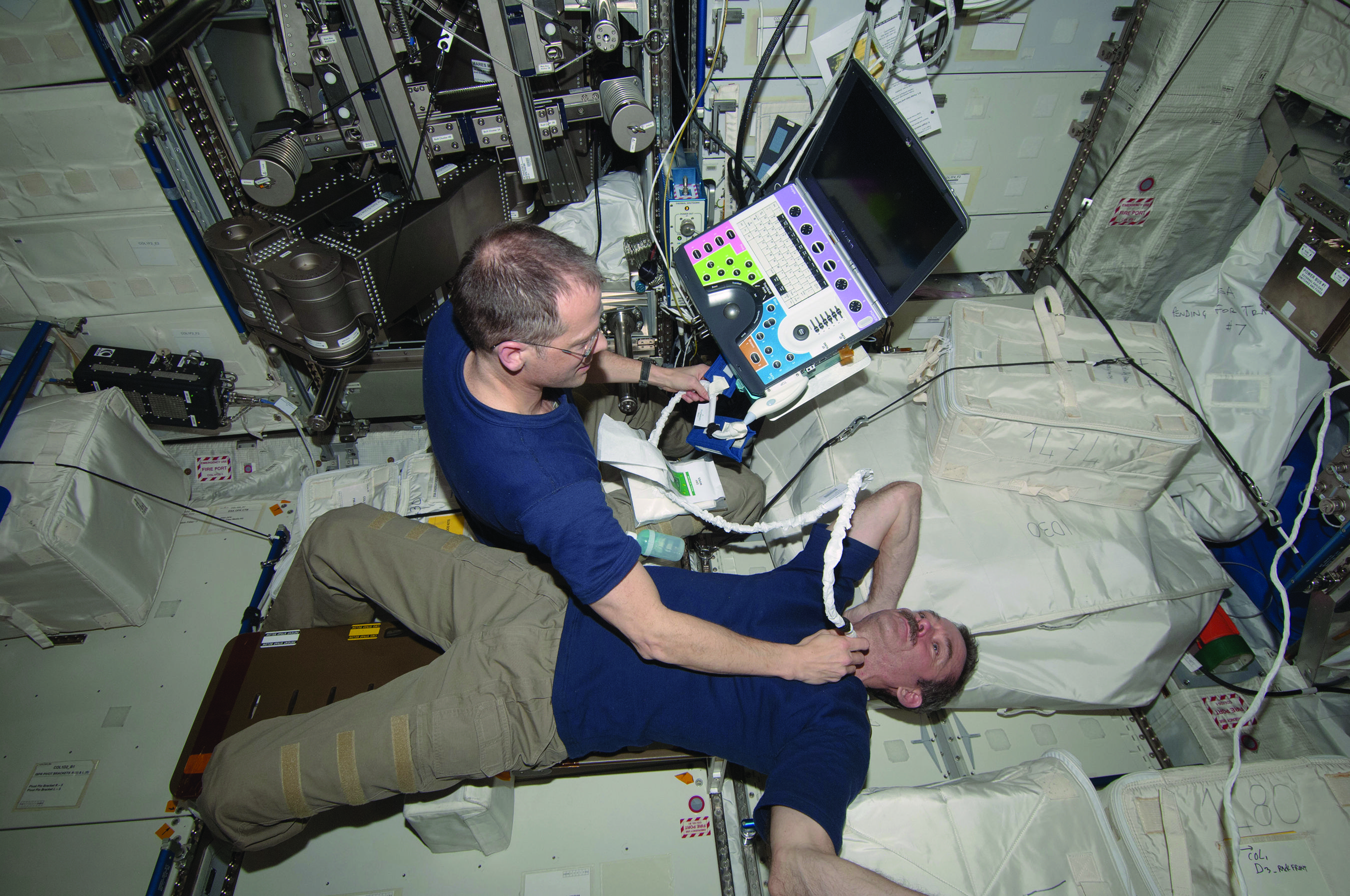 El astronauta de la NASA Tom Marshburn realiza una ecografía al astronauta canadiense Chris Hadfield en la ISS (Fuente: NASA).